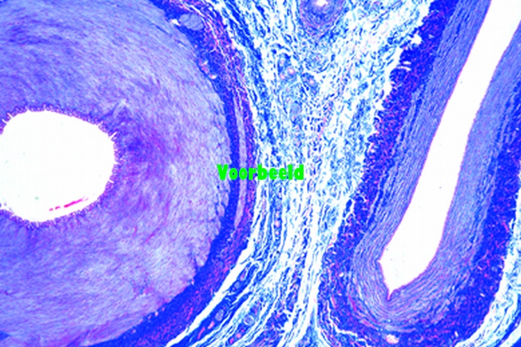 Artery and vein of smaller size in one s