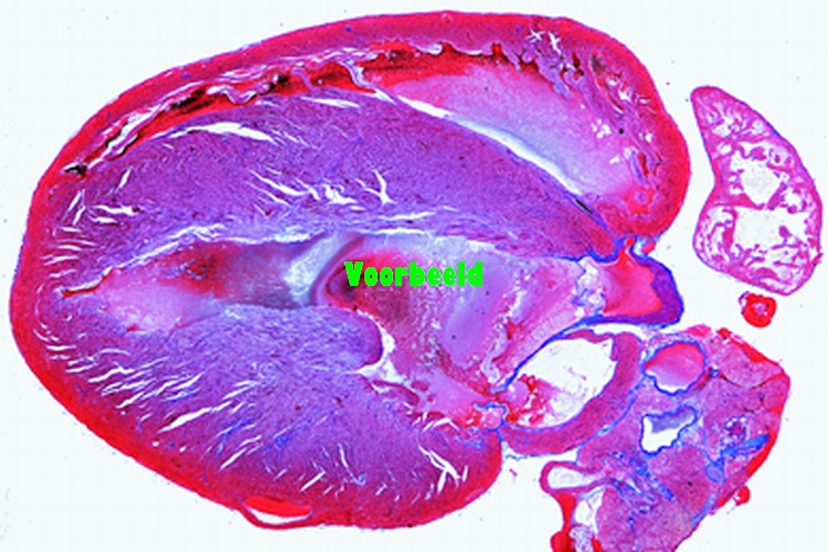 Heart of mouse, entire sagittal l.s.