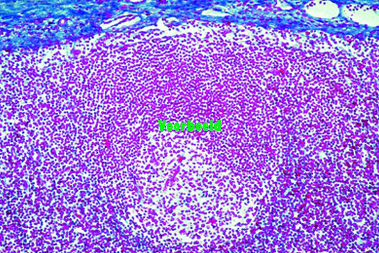Lymph node of cat, t.s. routine stained