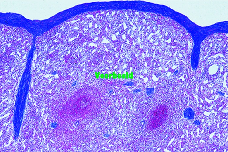Spleen of rabbit, t.s. showing capsula,