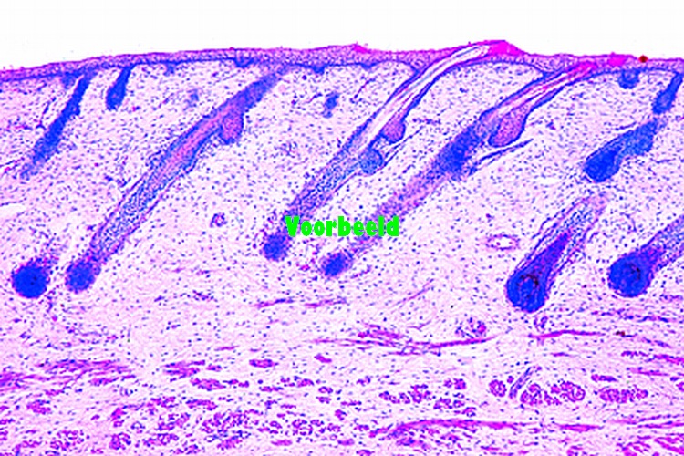 Human skin from foetus, vertical sec. sh