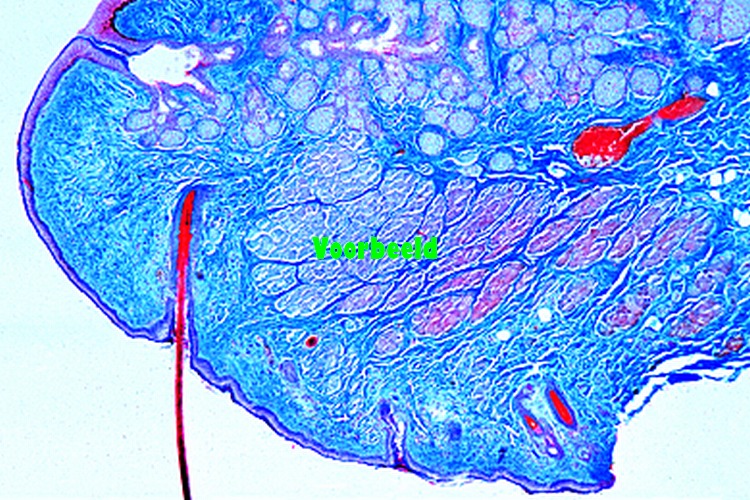 Eyelid of cat, t.s. showing Meibomian gl