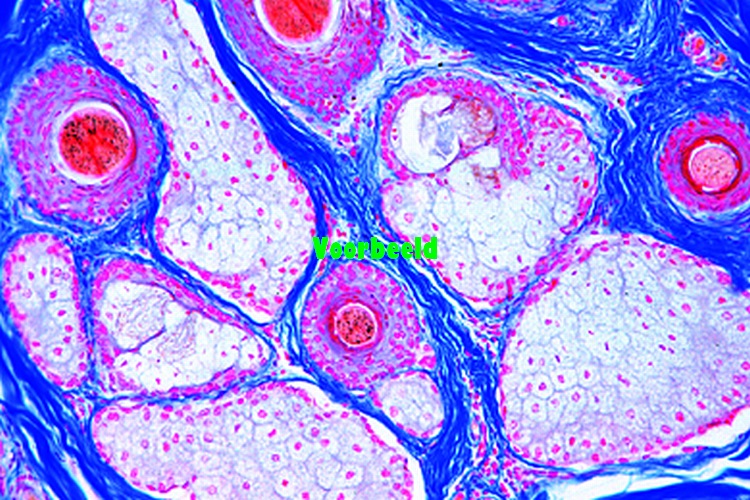 Skin with hairs, cat, vertical sec.