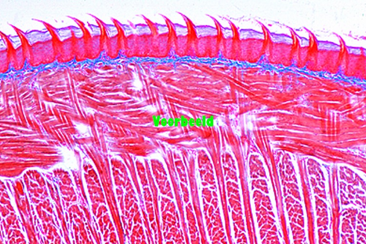 Tongue of cat, papilla with thick cornif