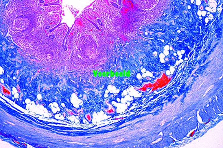 Appendix