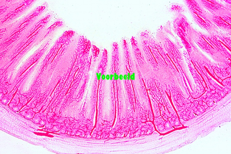 Small intestine of dog, injected to show