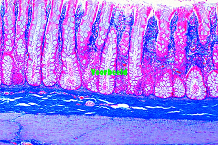 Colon, t.s. stained with muci-carmine or