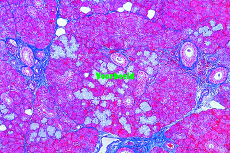 Submaxillary gland of cat, t.s. of a mix