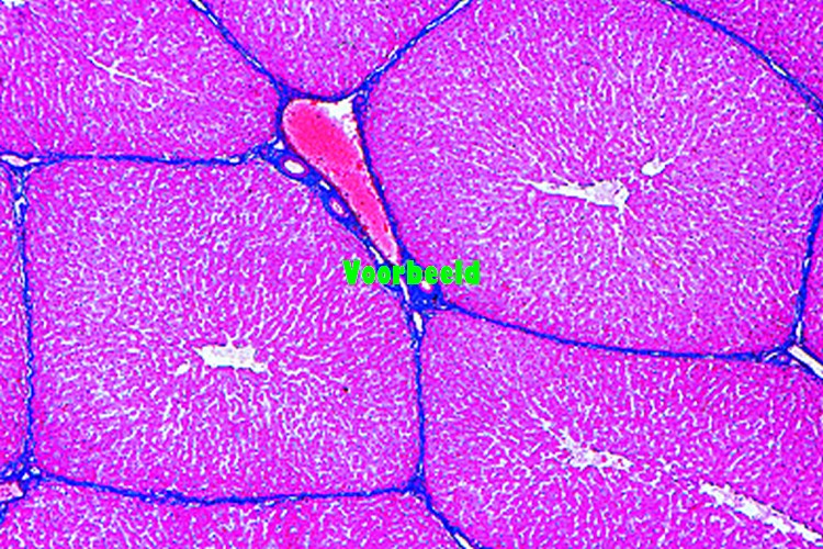Liver of pig, t.s. showing well develope