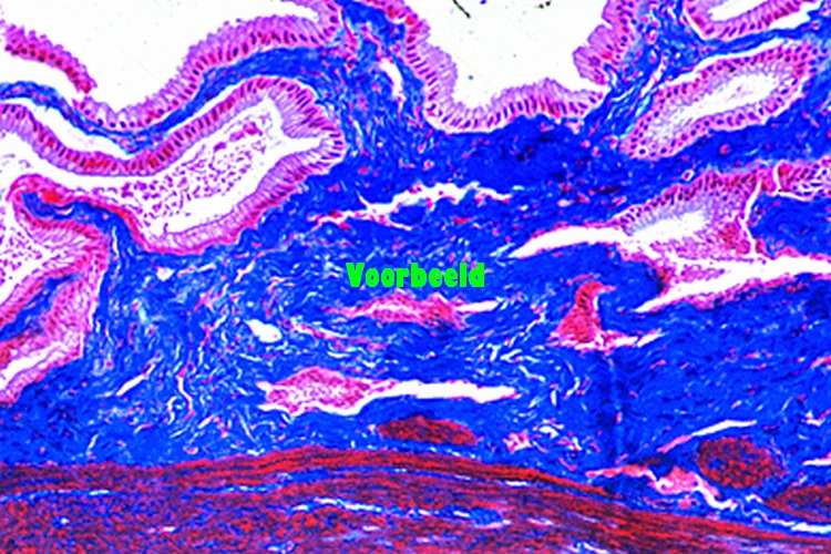 Gall bladder of sheep, t.s.