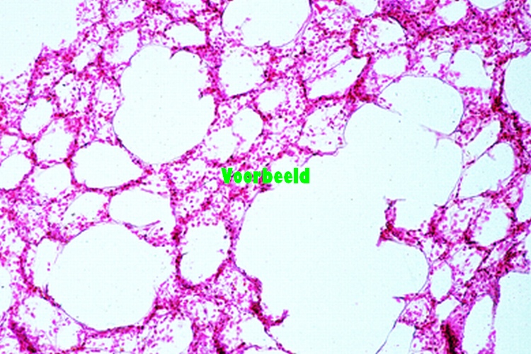 Lung of cat, t.s. stained for elastic fi