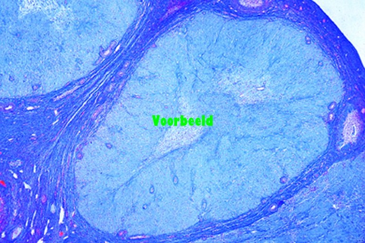 Corpus luteum