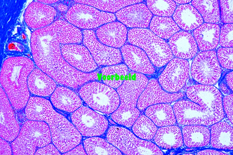 Testis of rat, t.s. showing spermatogene