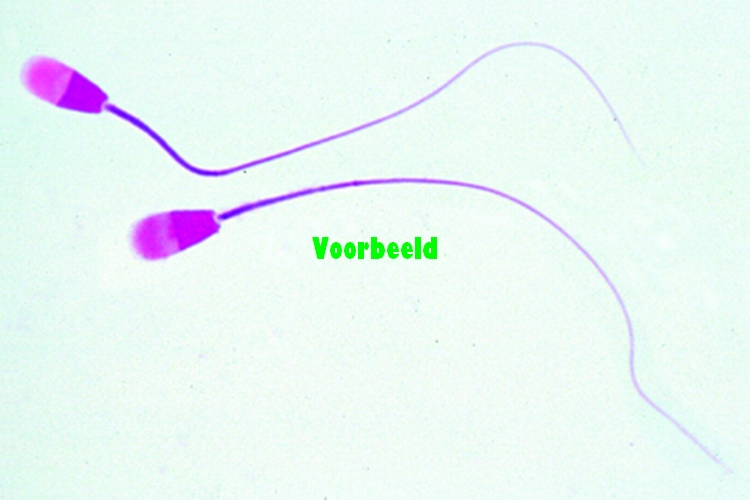 Sperm smear of bull