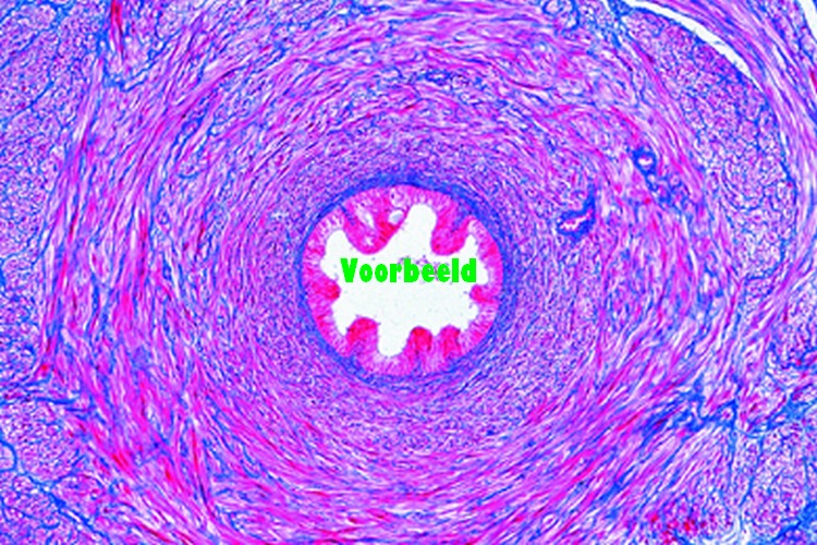 Spermatic cord (Ductus deferens) of pig