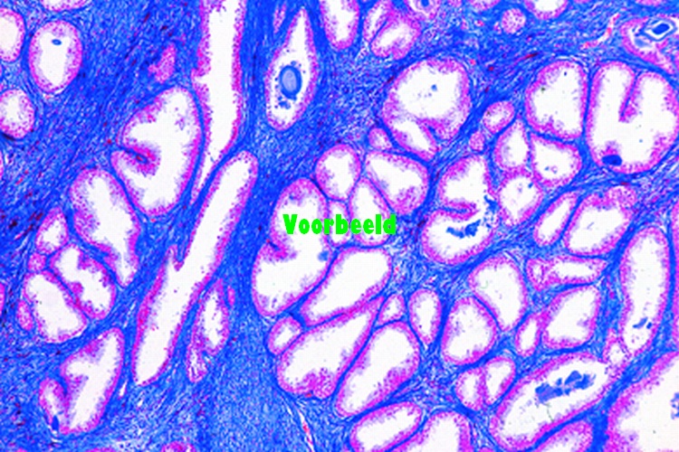Prostate gland of monkey, t.s.