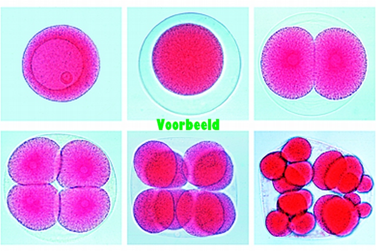 Development of sea urchin, eggs in diffe