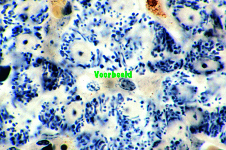 Chloroplasten