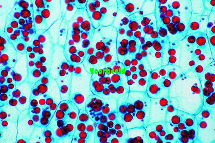 DNA in celkernen