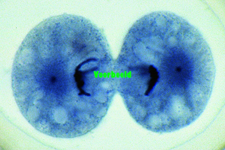 Eberthella typhi