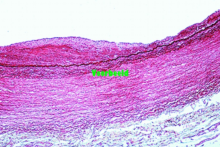 Psammechinus miliaris