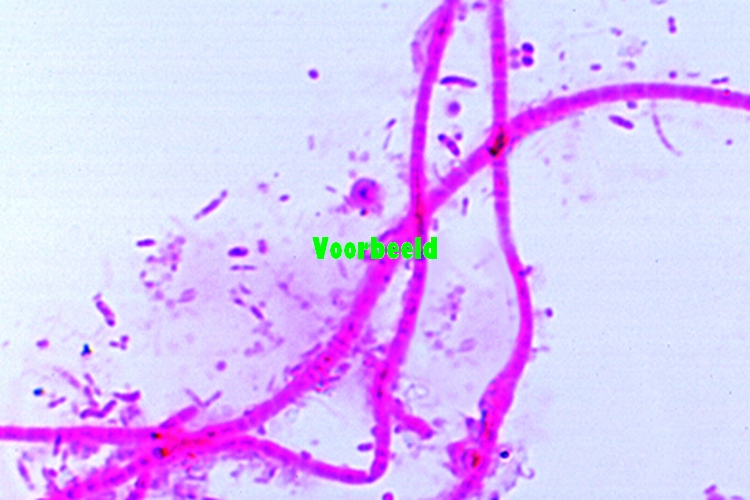 Desmidiaceae