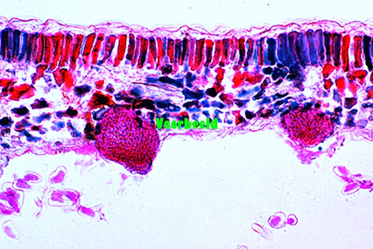 Plasmopara viticola