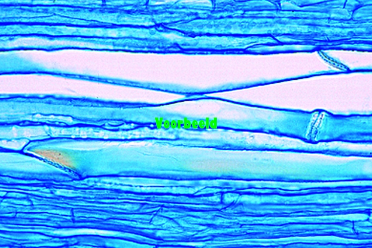 Cucurbita pepo, l.s. of stem with sieve