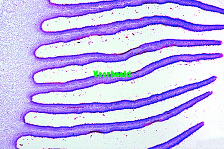 Champignon vruchtlichaam