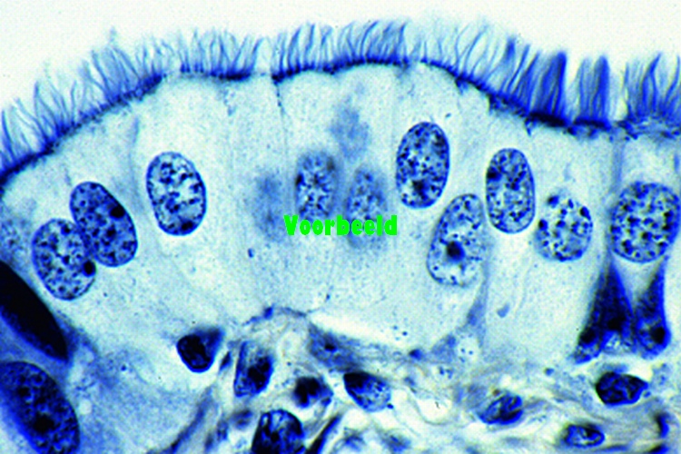 Simple ciliated columnar epithelium, in