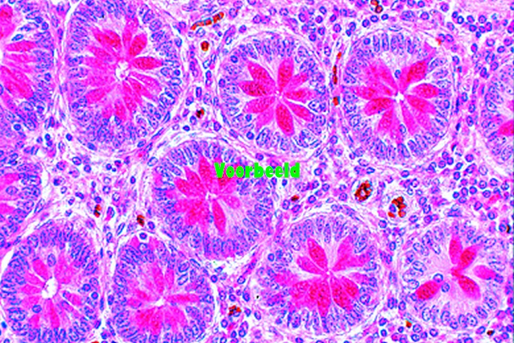 Glandular epithelium, in sec. of human c