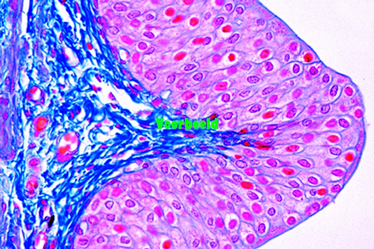Transitional epithelium, in sec. of huma