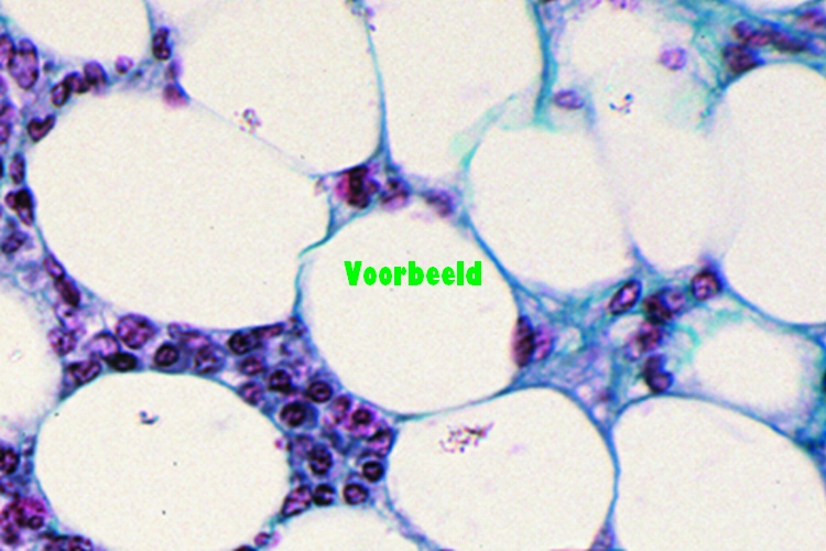 Adipose tissue, human, sec. fat removed