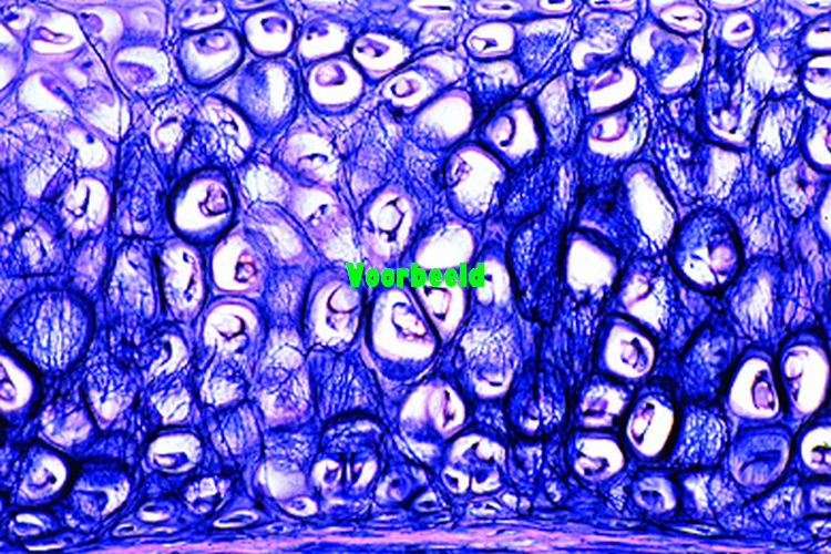 Yellow elastic cartilage, human, sec. st