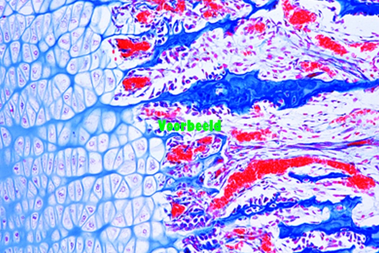 Bone development (intracartilaginous), l
