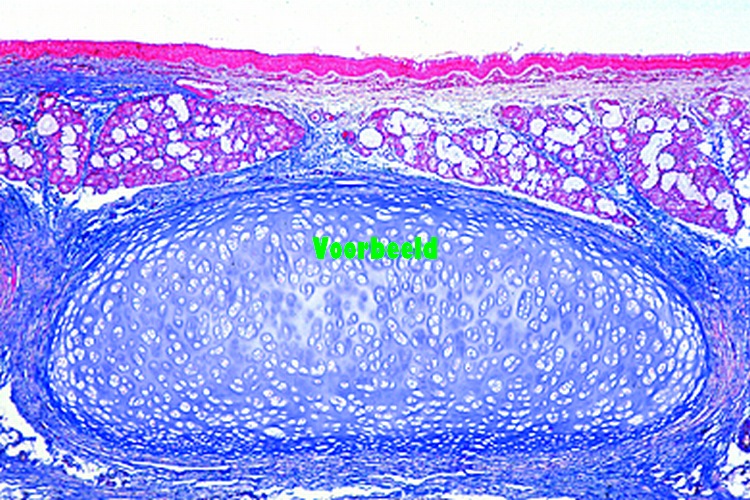 Trachea, human l.s.