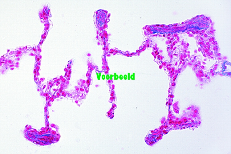 Lung from human foetus, sec.