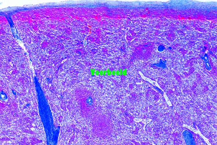 Spleen, human t.s.
