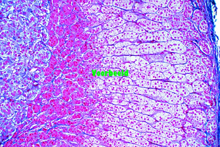 Adrenal gland (Gl. suprarenalis), human