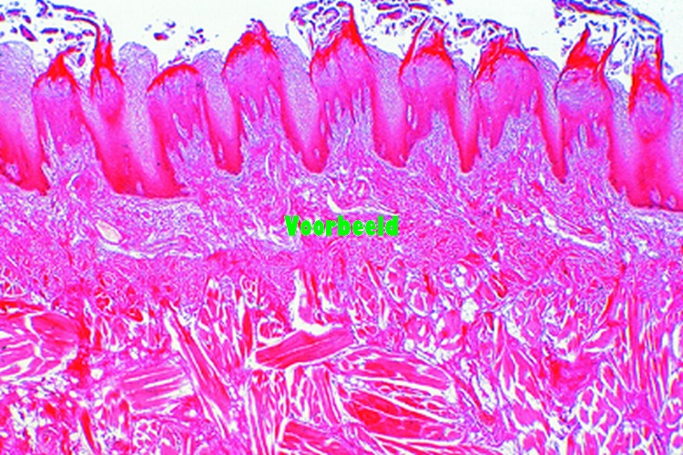 Tongue, human, sec. with filiform papill