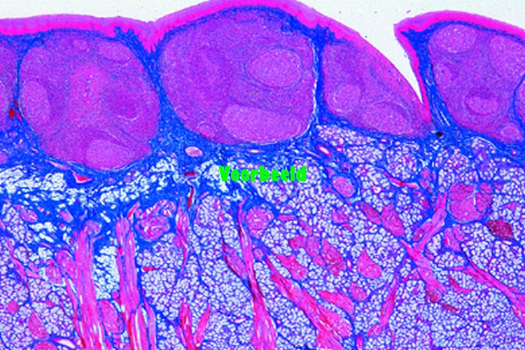 Soft palate, human t.s.