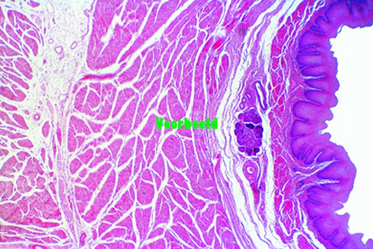 Oesophagus, human t.s.