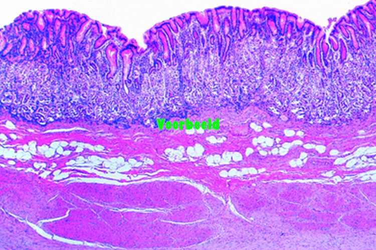 Stomach, fundic region, human t.s.