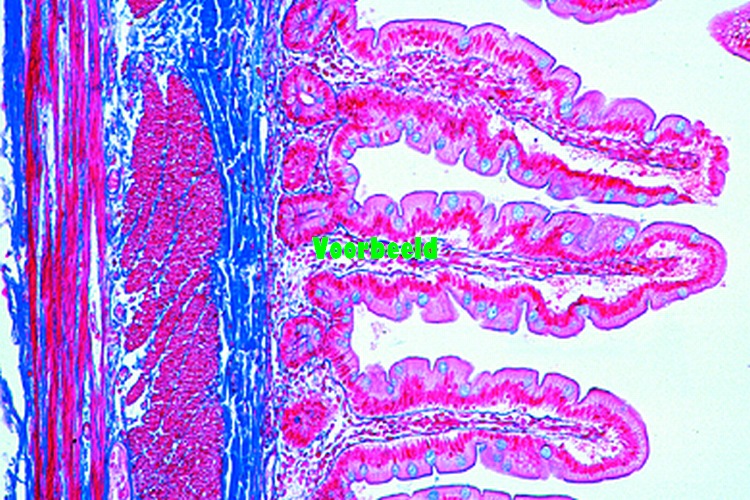 Jejunum, human t.s.