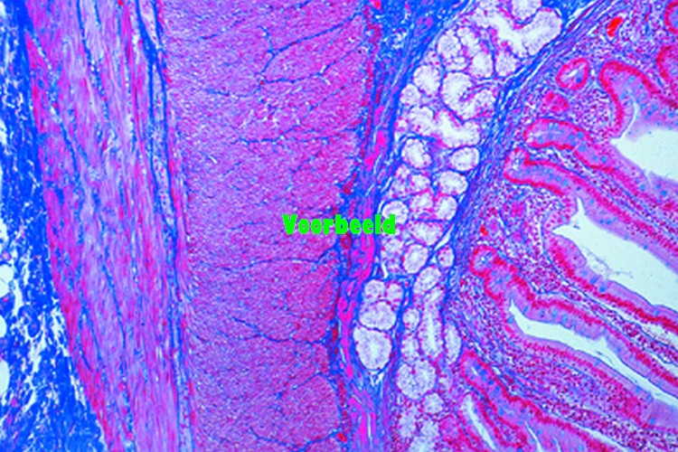 Ileum, human t.s.