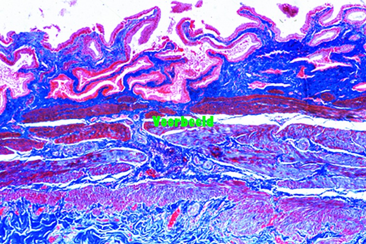 Gall bladder, human t.s.