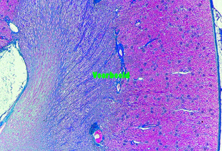 Kidney, human t.s.
