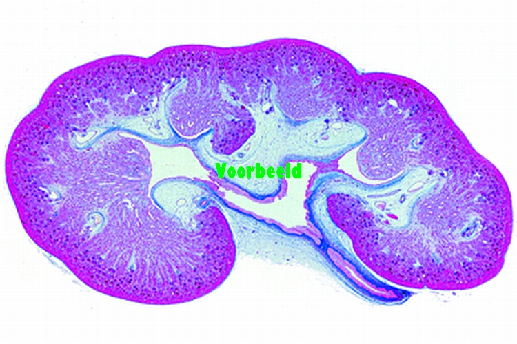 Kidney from human foetus, t.s.
