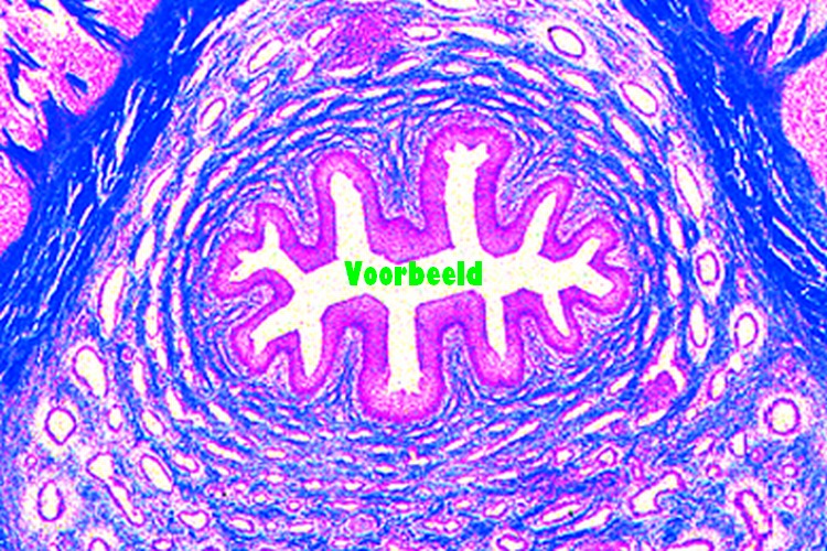 Urethra, prostatic part, human t.s.