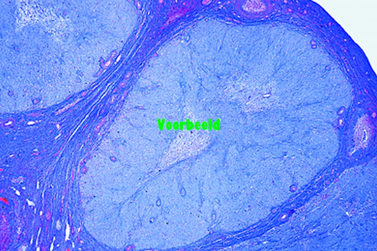 Ovary with Corpus luteum, human t.s.